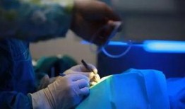 近视激光手术爆料视频大全,爆料视频大全深度解析